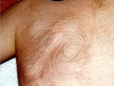 fig.1