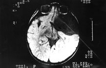 fig.2